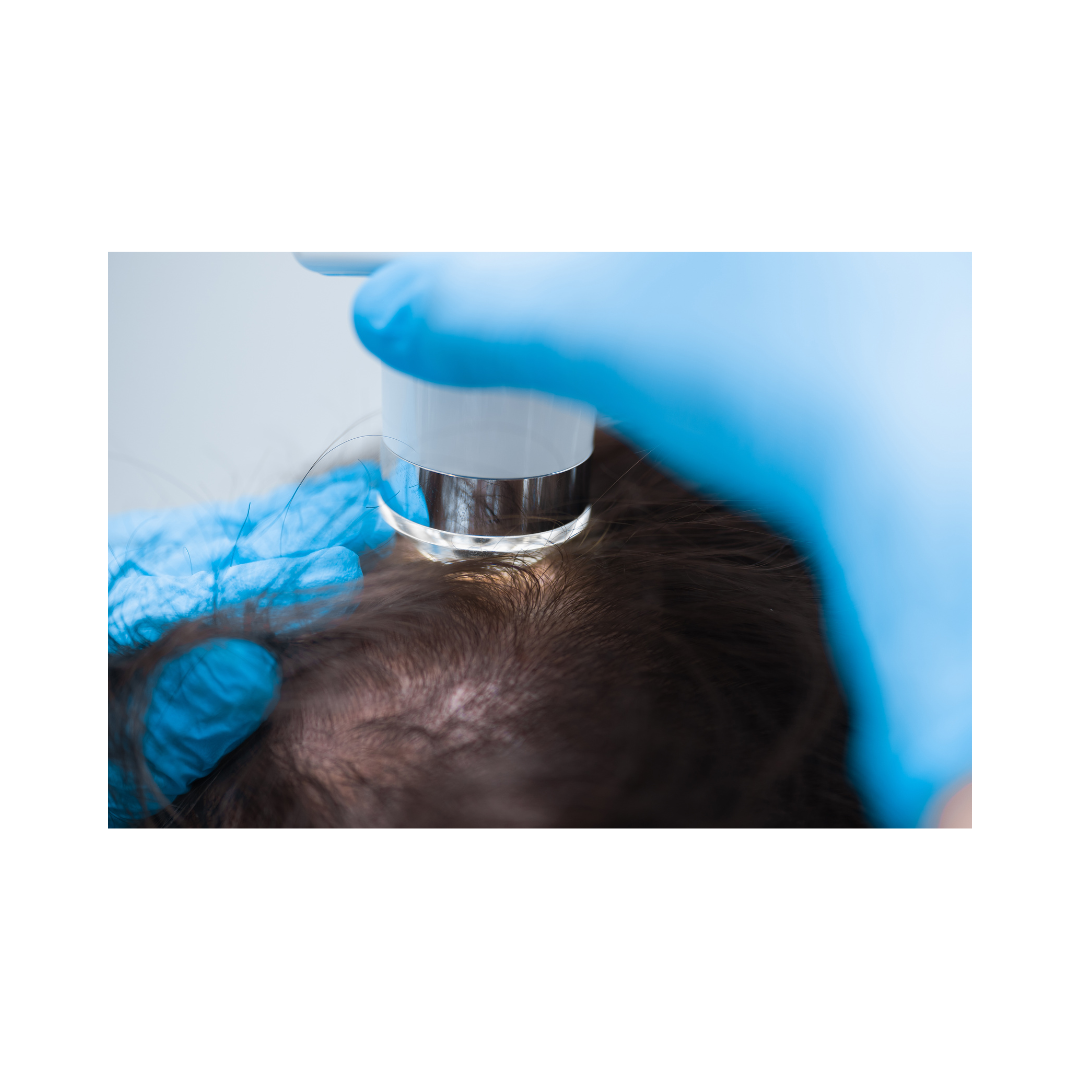 Trichological consultation